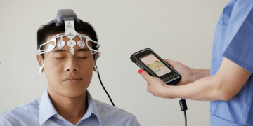 Exploring Deep Brain Stimulation and Stem Cell Therapy